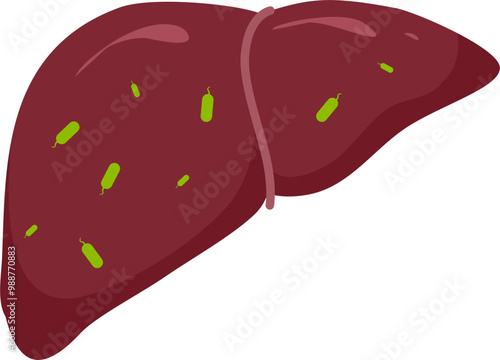Liver disease illustration 