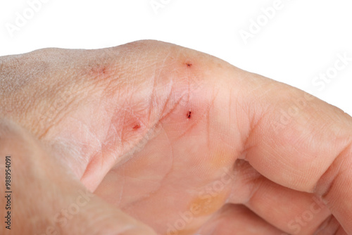 Canvas Print cat bite marks on hand, isolated