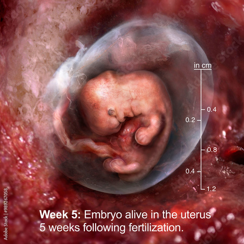 Embryo alive in the uterus 5 weeks following fertilization photo