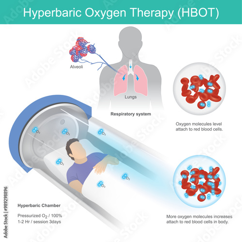 Hyperbaric Oxygen Therapy. A man has recumbent in tunnel glass for hyperbaric oxygen therapy pass by respiratory into blood vessel. photo