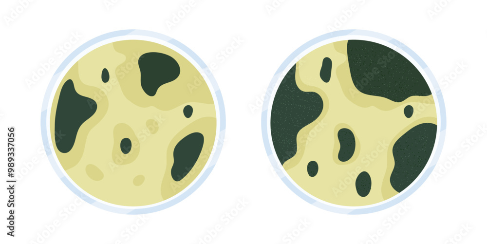 Glass Petri dish with culture. Top view on cell-culture dish. Cell culture illustration Glass Petri dish with culture. Top view on cell-culture dish. Cell culture illustration