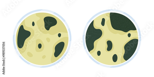 Glass Petri dish with culture. Top view on  cell-culture dish. Cell culture illustration