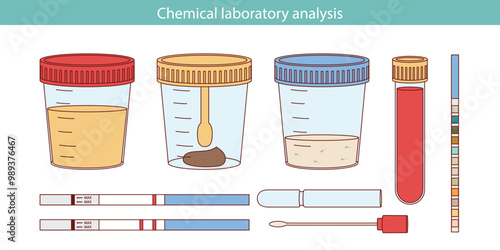 Medical analysis, laboratory analysis of urine, stool, sperm in plastic jars, Probe swab, pregnancy test, urine test, in vitro blood test. Chemical laboratory analysis.
