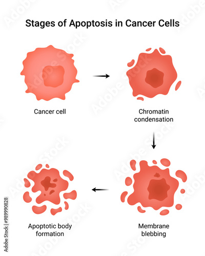 Stages of Apoptosis in Cancer Cells