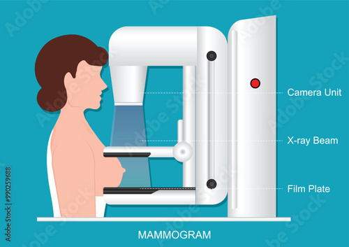 Mammography also called mastography DICOM modality or MG.