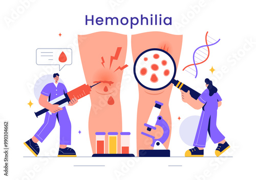 Hemophilia Vector Illustration Featuring a Doctor Examining an Injured Knee or Joint and Blood Disorders in a Healthcare Flat Style Cartoon Background