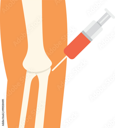 Medical illustration showing a doctor injecting cortisone into a patient's knee to treat pain and inflammation