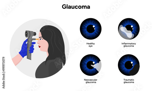 Ophthalmology eye testing. Pneumotonometer. Inflammatory glaucoma. Neovascular glaucoma. Traumatic glaucoma