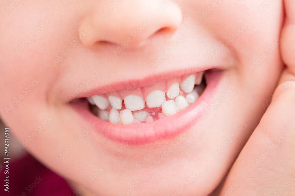 Obraz premium Health care and dental hygiene concept. Close up portrait of little girl without milk teeth.