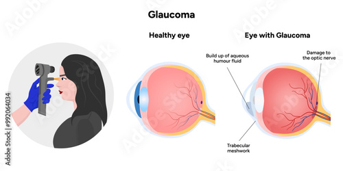 Ophthalmology eye testing. Pneumotonometer. Eye anatomy