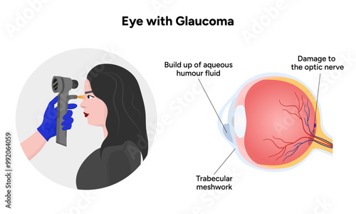 Ophthalmology eye testing. Pneumotonometer. Eye anatomy glaucoma