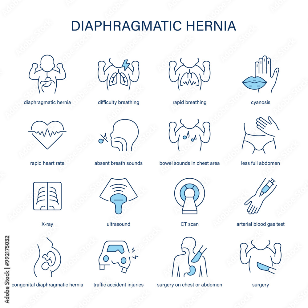 Diaphragmatic Hernia symptoms, diagnostic and treatment vector icon set. Medical icons. Diaphragmatic Hernia symptoms, diagnostic and treatment vector icon set. Medical icons.
