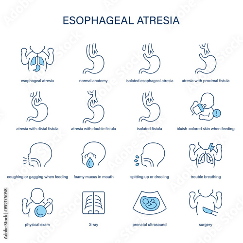 Esophageal Atresia symptoms, diagnostic and treatment vector icon set. Medical icons.	