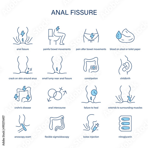 Anal Fissure symptoms, diagnostic and treatment vector icon set. Medical icons.	
