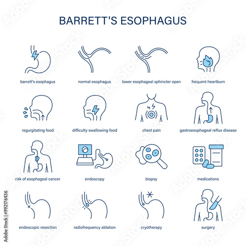 Barrett's Esophagus symptoms, diagnostic and treatment vector icon set. Medical icons.	