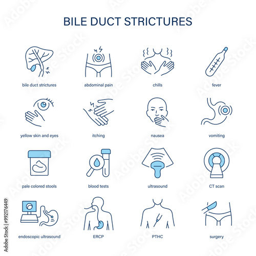 Bile Duct Strictures Syndrome symptoms, diagnostic and treatment vector icon set. Medical icons.	