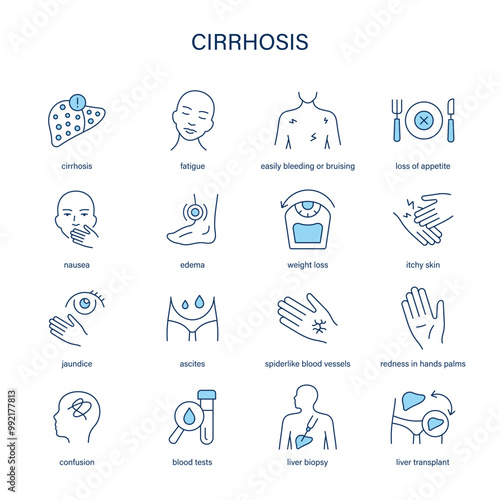 Cirrhosis symptoms, diagnostic and treatment vector icon set. Medical icons.