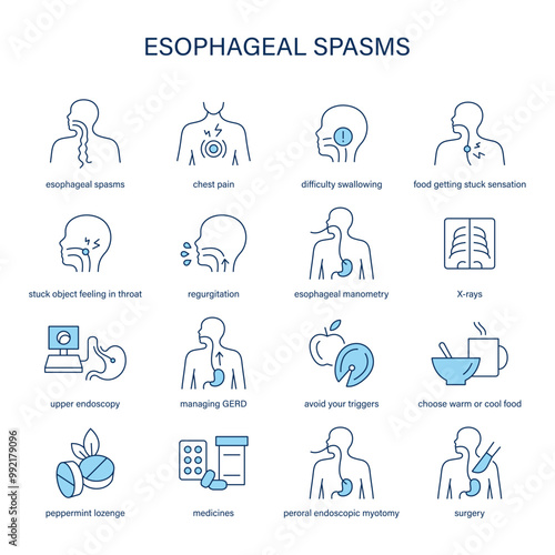 Esophageal Spasms symptoms, diagnostic and treatment vector icon set. Medical icons.	