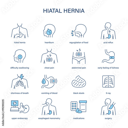 Hiatal Hernia symptoms, diagnostic and treatment vector icon set. Medical icons.	