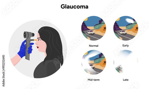 Ophthalmology eye testing. Pneumotonometer. Inflammatory glaucoma. Neovascular glaucoma. Traumatic glaucoma