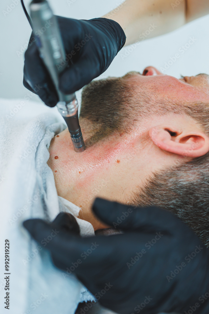 Fototapeta premium A cosmetologist cleans the skin of a man's face. A man does facial procedures in a cosmetic clinic. Male cosmetology.