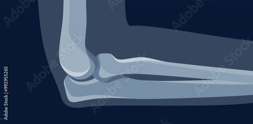 Human elbow x ray roentgen image for medical diagnostic vector flat illustration