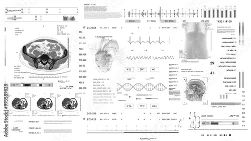 MRI x ray CT Scan.Heart rate monitor Medical HUD monitoring. Futuristic Technological Interface. Sceleton, 3D Model.Healthcare.white