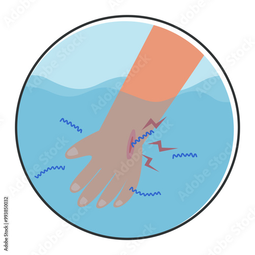 leptospirosis infection disease from leptospira bacteria in rat urine