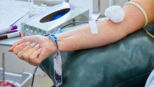 Obraz na plátně A person is shown donating blood, with a collection tube drawing blood from their arm into a blood bag, emphasizing the act of compassion and medical safety