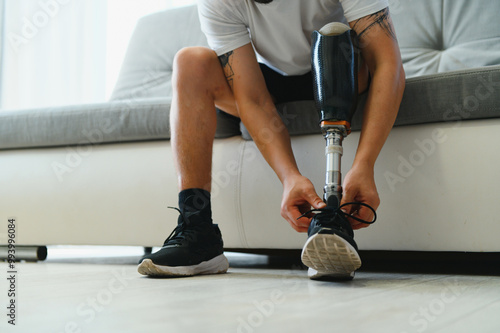 Φωτογραφία Man amputee with prosthetic leg disability on above knee transfemoral leg prosthesis wearing shoe sitting on sofa, close up