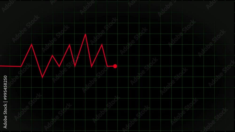 Close Up Heart Rate Monitor Pulse Flatline Close Up Heart Rate Monitor Pulse Flatline
