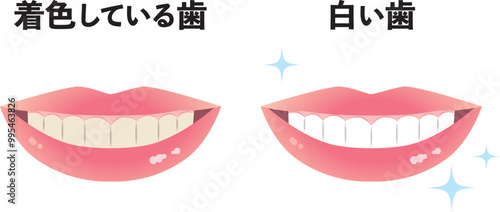 着色している歯と白い歯