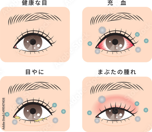 ハウスダストによる目のトラブルセット