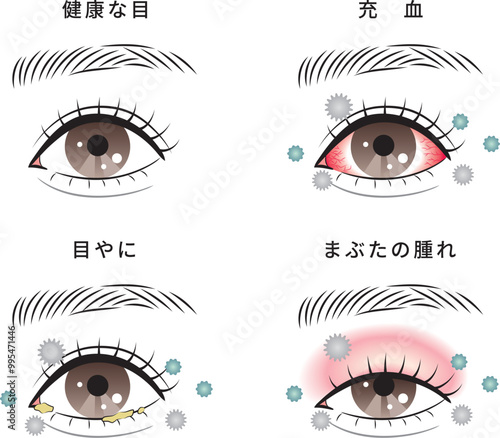ハウスダストによる目のトラブルセット