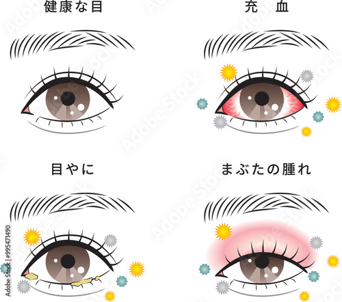 花粉症とハウスダストによる目のトラブルセット