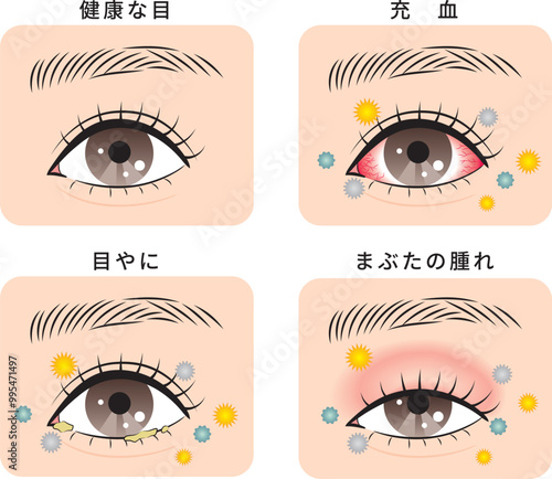 花粉とハウスダストによる目のトラブルセット