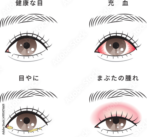 目のトラブルセット