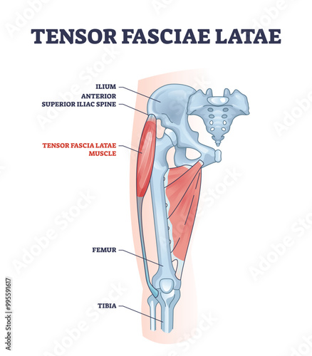 An anatomical diagram showing the Tensor Fasciae Latae muscle and its location on the hip and thigh, highlighting key skeletal structures, diagram.