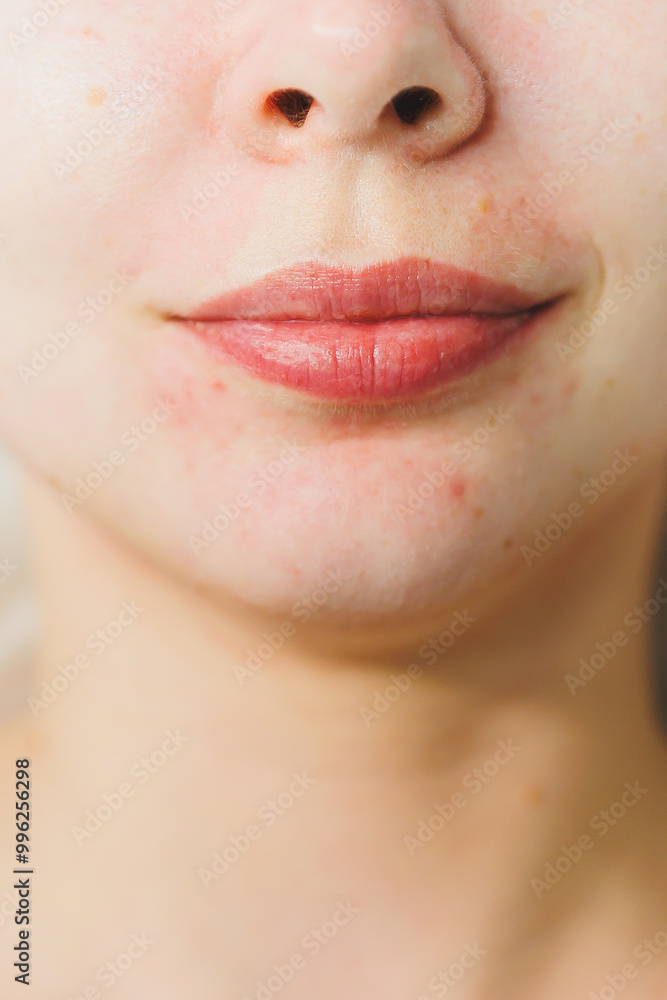 Obraz premium Problem skin of a woman's face. Applying a mask to the skin of a woman's face.