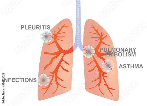 Lungs pain disorders. vector illustration