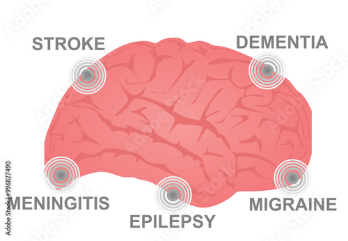 Brain neurological disorders. vector illustration