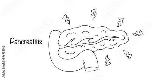 Pancreatitis