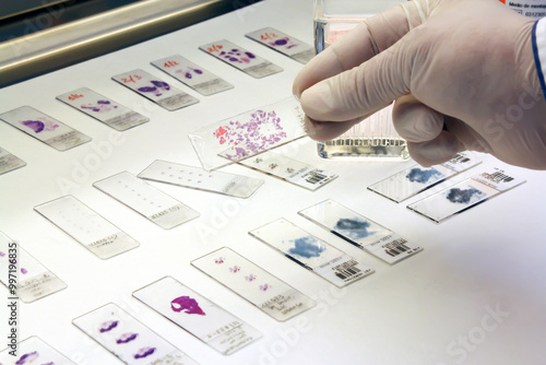 Hands of laboratory assistant holding a petri plate; Laboratory glassware, science laboratory research concept.
