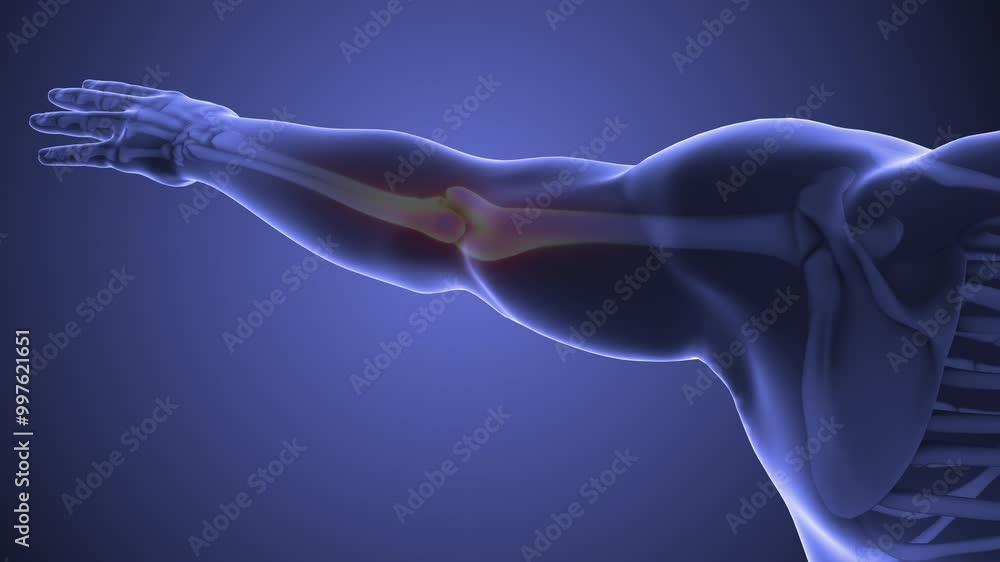 Medical disease involving elbow joint pain Medical disease involving elbow joint pain