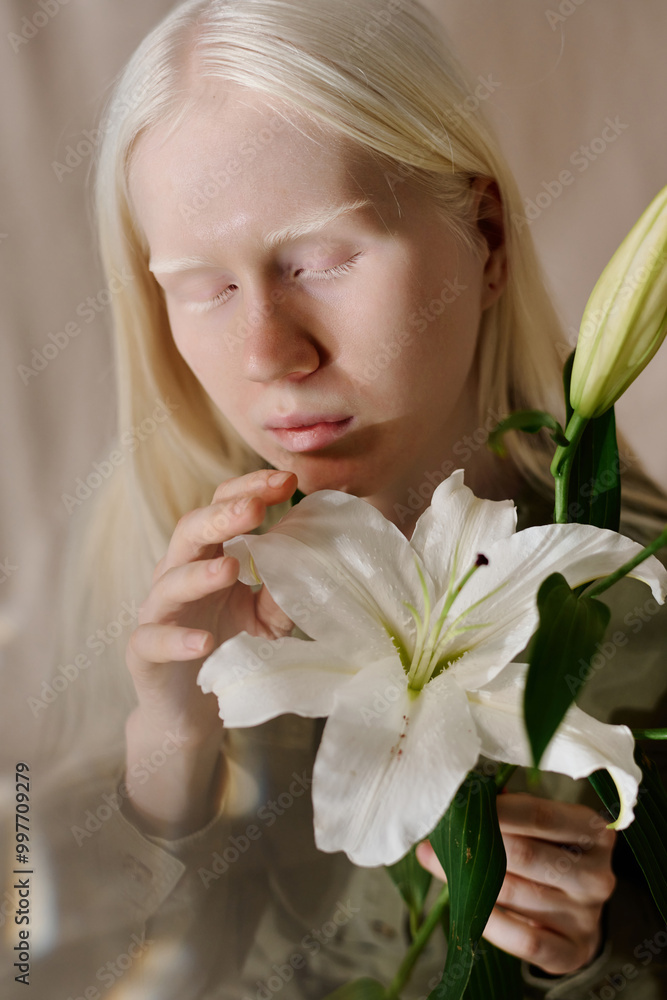 Vertical closeup of young Caucasian girl with albinism embracing beauty of fresh lilium flower Vertical closeup of young Caucasian girl with albinism embracing beauty of fresh lilium flower