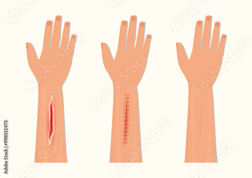 Wound Suturing and Suture Care.