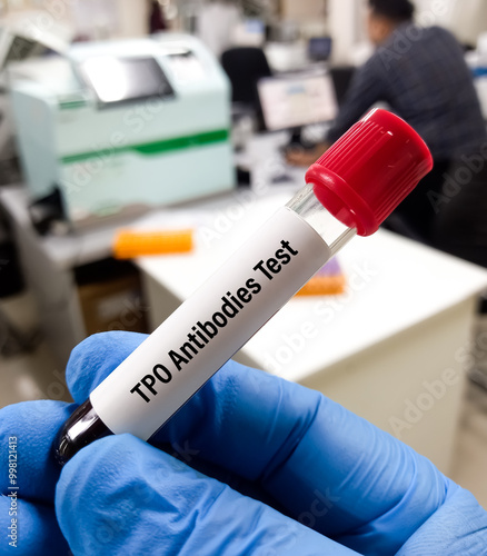 Blood sample for Thyroid Peroxidase Antibodies or Anti-TPO test and anti-Tg Test. Thyroid function tests, to diagnosis of hypothyroidism and thyroiditis. photo