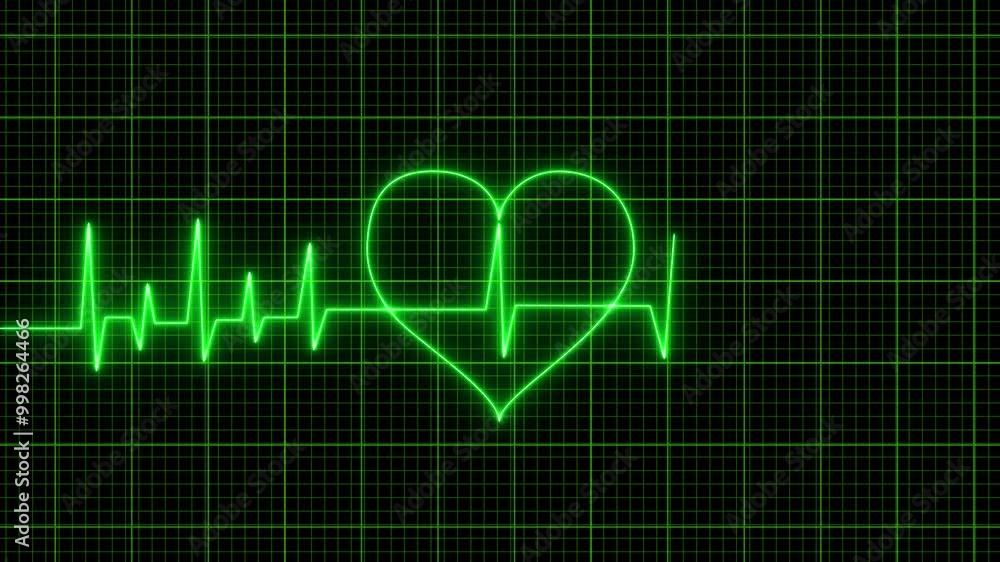 Neon Heart Beat ECG EKG Animation Background. Abstract Glowing Neon Heart Beat Single Loop Animation. Cardiogram Heart Pulse Moving, Medical Science Human Heart Beat Motion Loop Bg Neon Heart Beat ECG EKG Animation Background. Abstract Glowing Neon Heart Beat Single Loop Animation. Cardiogram Heart Pulse Moving, Medical Science Human Heart Beat Motion Loop Bg