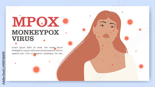 Danger of Mpox virus concept banner. Infected woman from monkey flat illustration