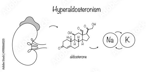 Hyperaldosteronism